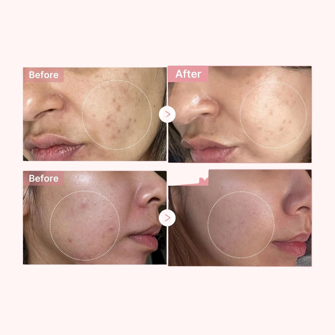 Medicube Set Skincare Pink Glow UP