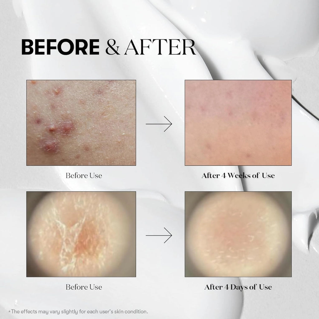 Vt Cosmetics Serum Microagujas Reedle Shot 100