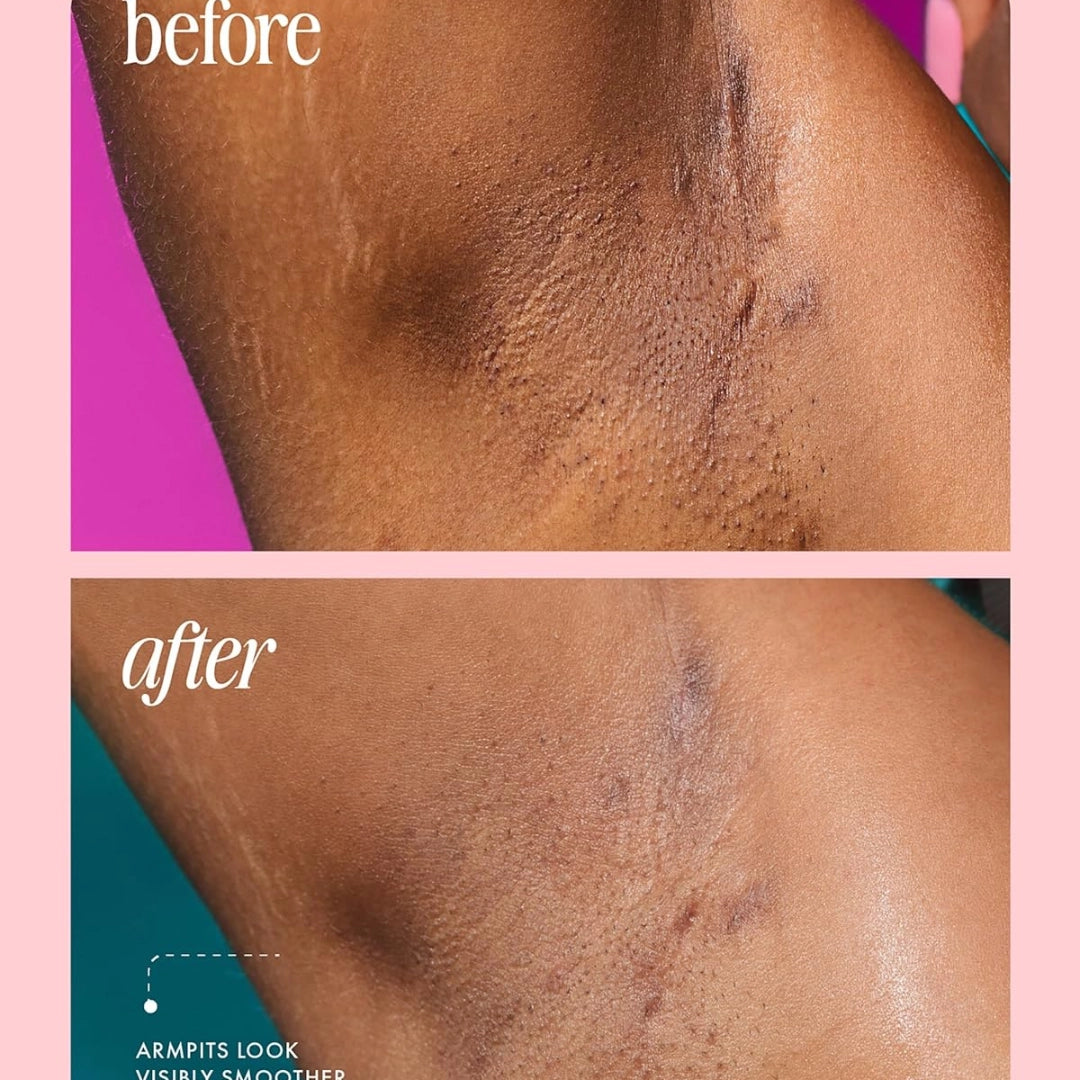 Desodorante Truly Aclarador - Libre De Aluminio Unicorn Fruit Truly