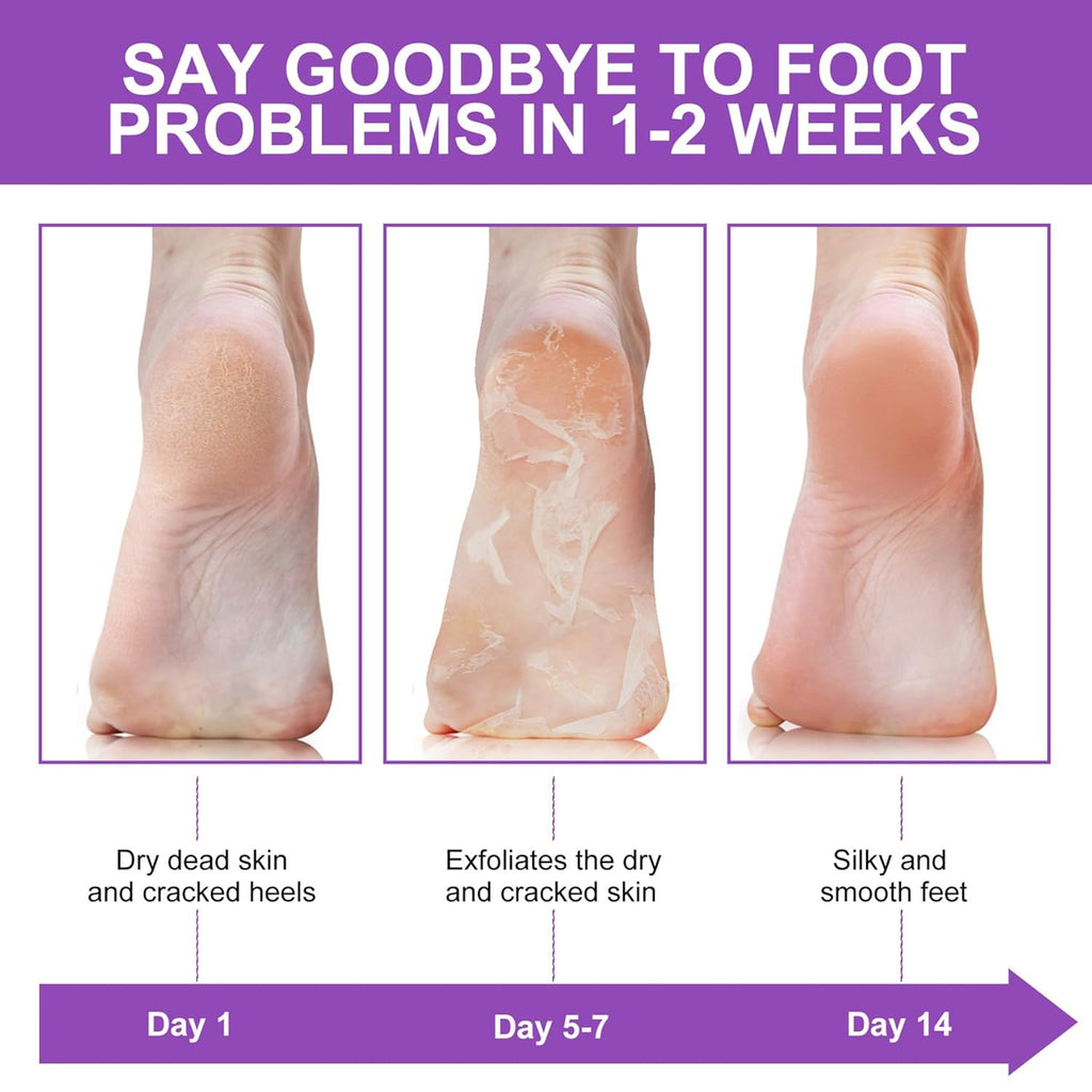 Exfoliante y removedor de callos para pies