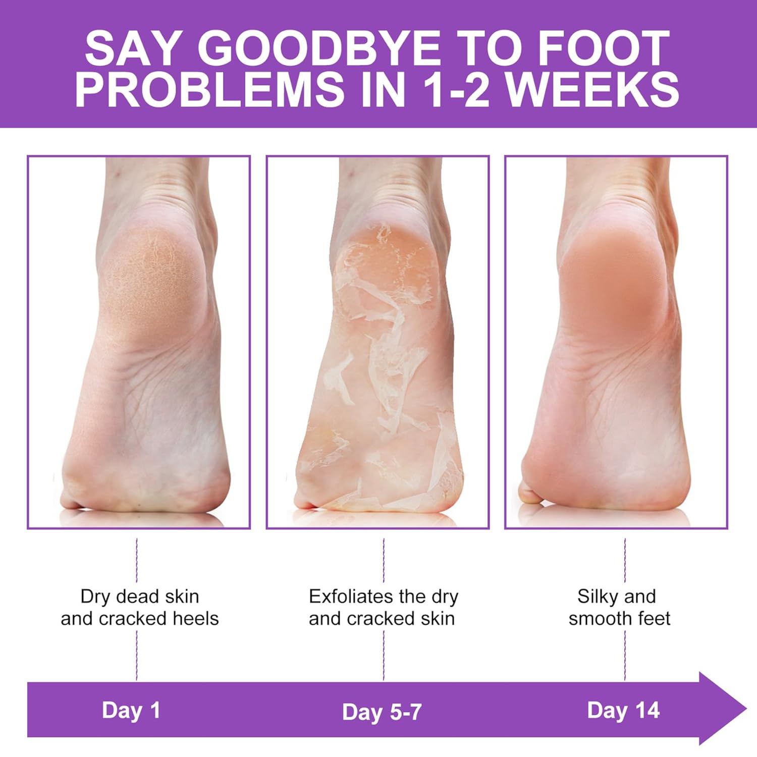 Exfoliante y removedor de callos para pies