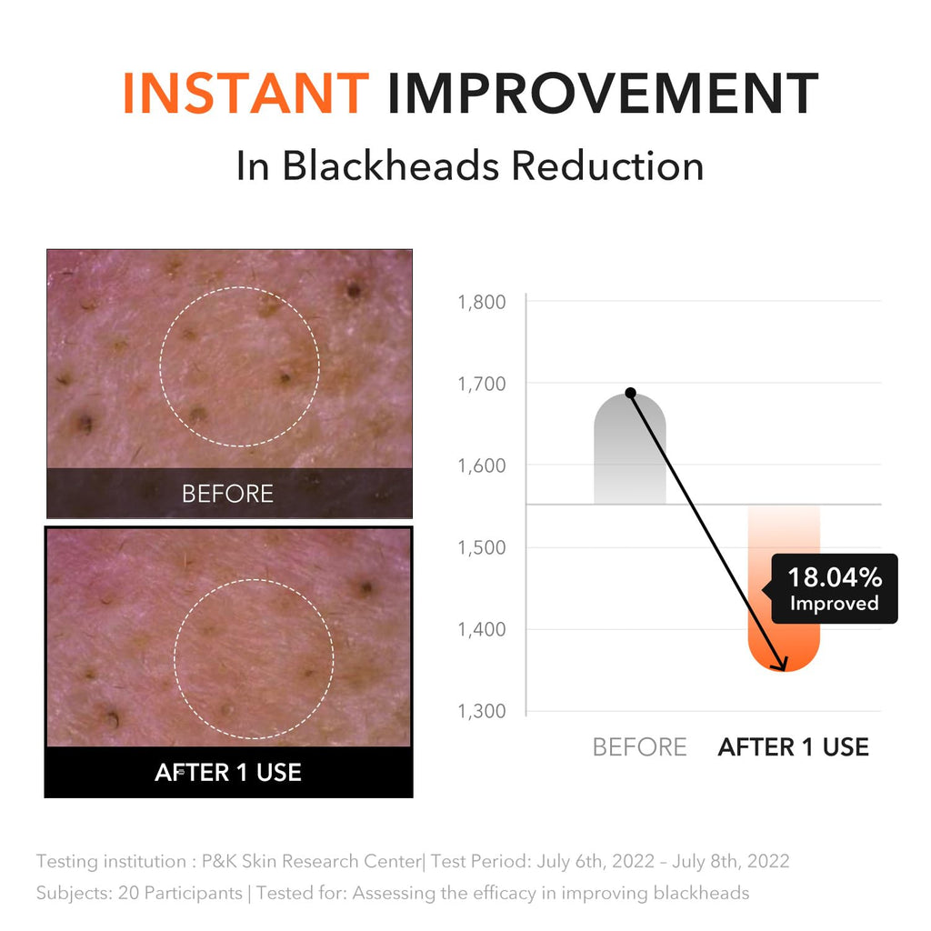 Bálsamo limpiador APRILSKIN Carrotene IPMP Hydromelt