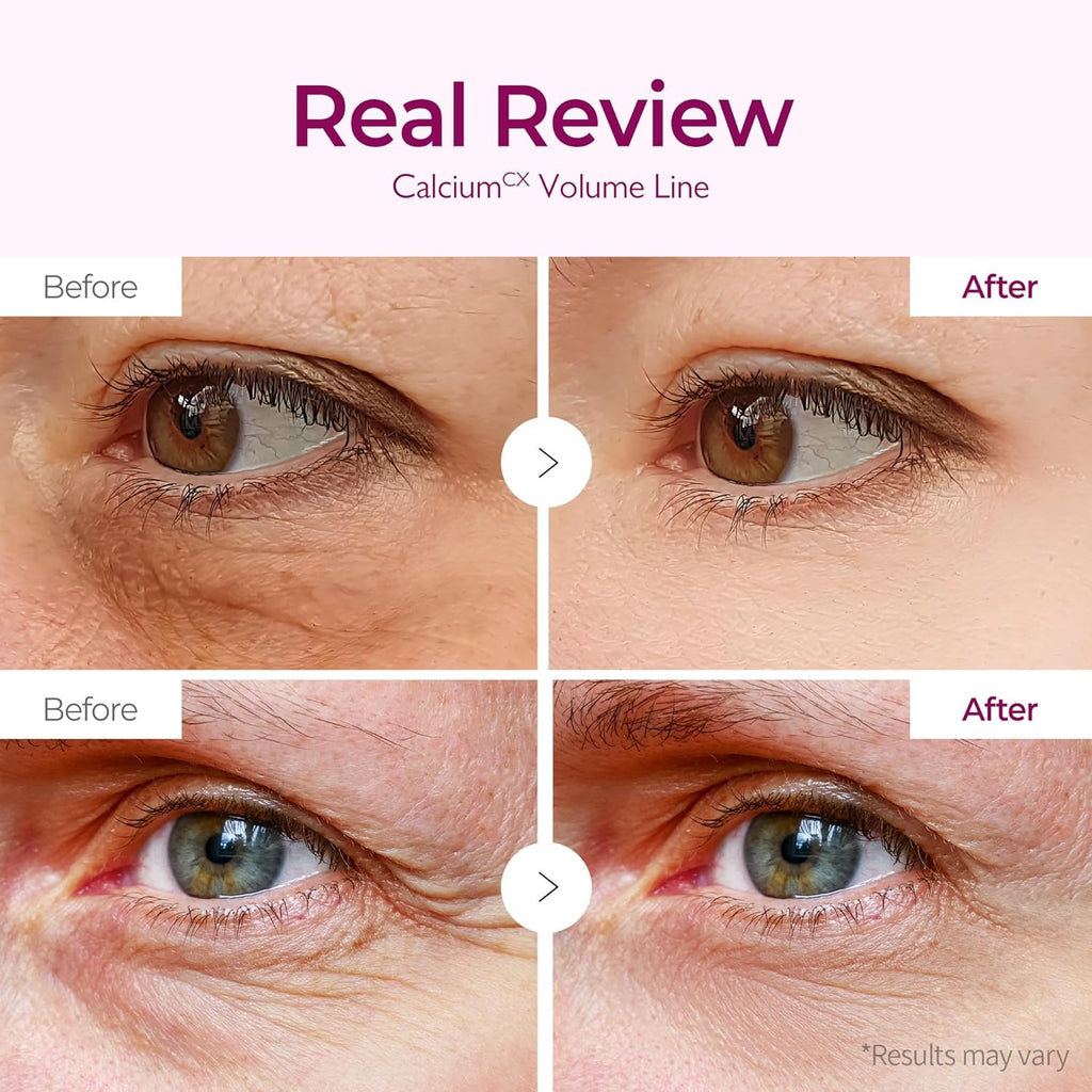 Dr.Melaxin Parche contorno de ojos volumen de calcio