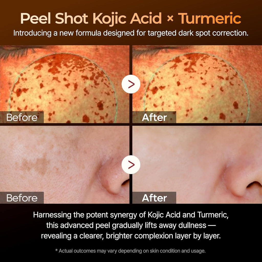 Dr. Melaxin Peel Shot Suero de ácido kójico y cúrcuma 80ml