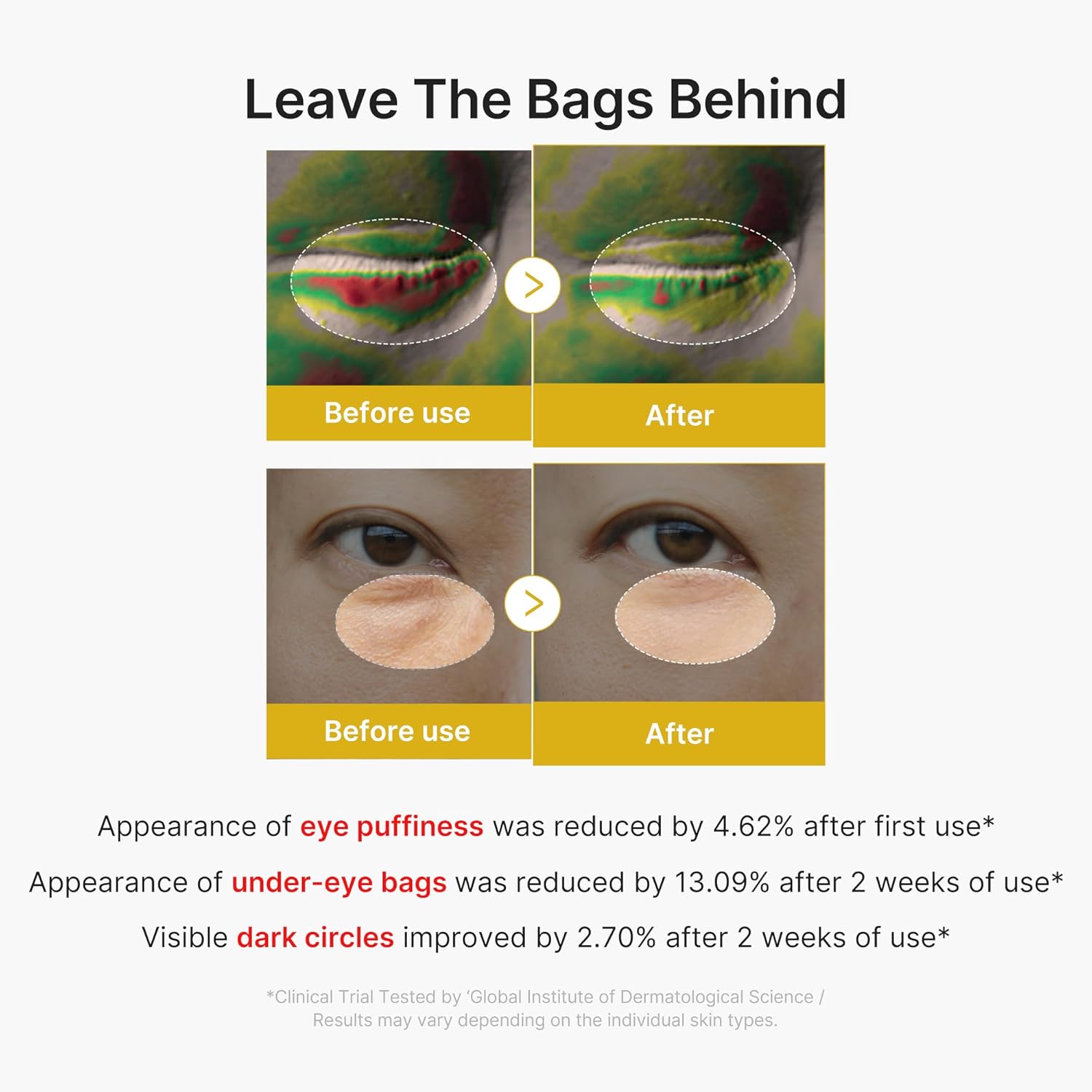 medicube Suero para ojos con ácido kójico