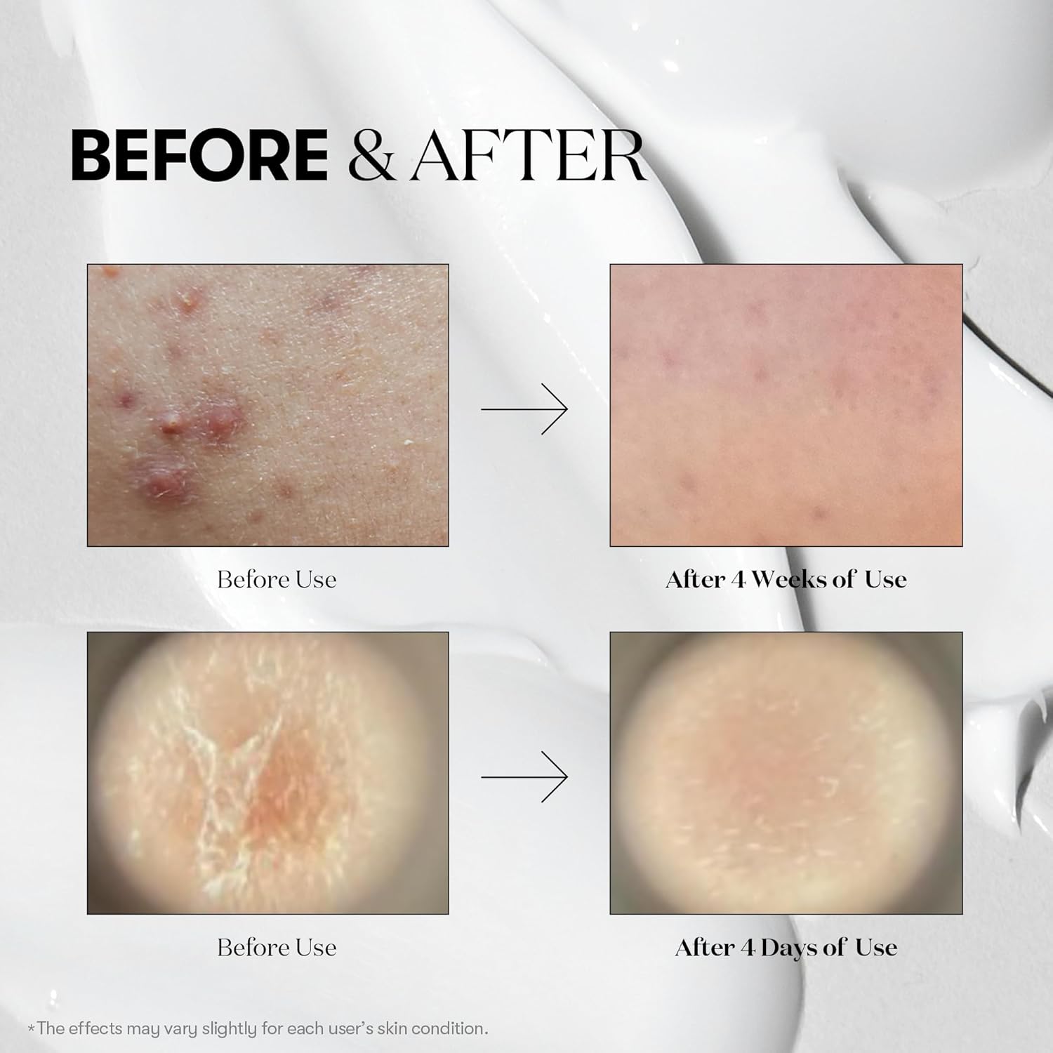 Suero Microagujas Reedle Shot 100 Vt Cosmetics