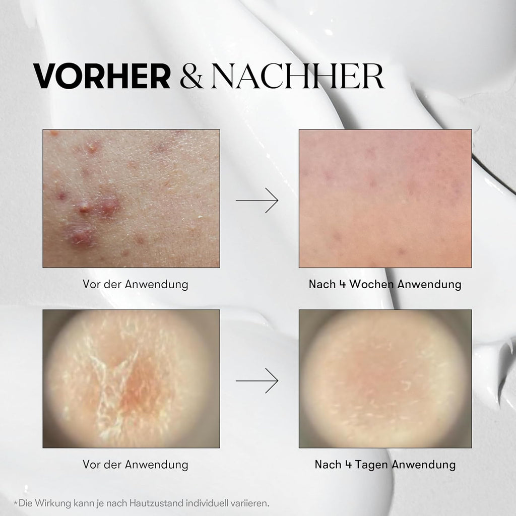 Serum Reedle Shot 300 Vt Cosmetics 50ml