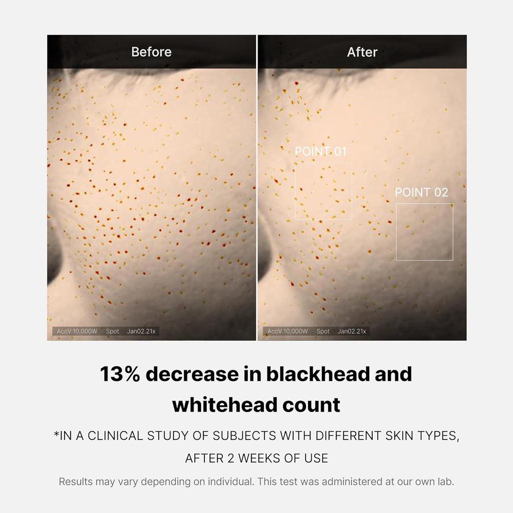 Serum exfoliante One Day Exosome Shot Pore Medicube
